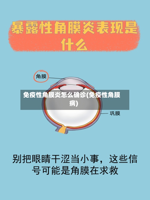 免疫性角膜炎怎么确诊(免疫性角膜病)-第2张图片