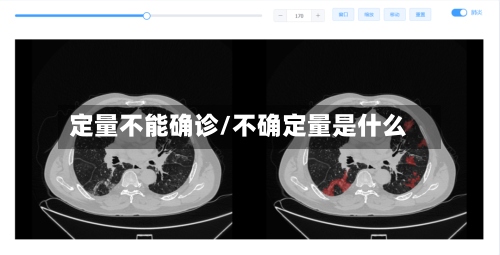 定量不能确诊/不确定量是什么-第2张图片