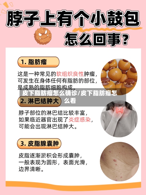 皮下脂肪瘤怎么确诊/皮下脂肪瘤怎么看-第2张图片