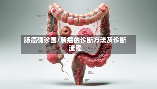 肠癌确诊图/肠癌的诊断方法及诊断流程