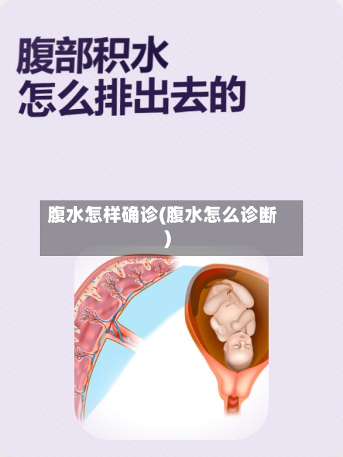 腹水怎样确诊(腹水怎么诊断)