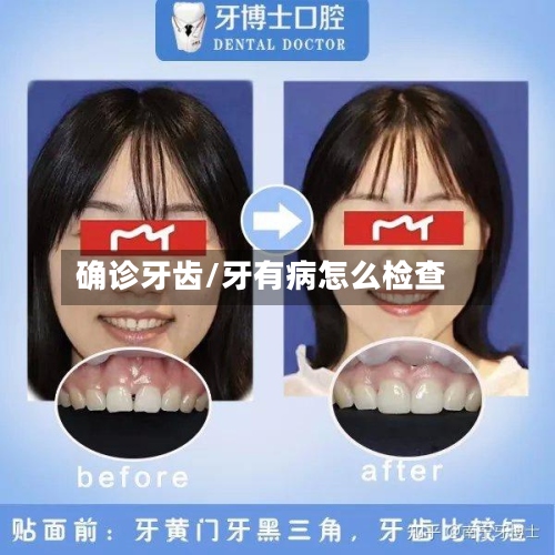 确诊牙齿/牙有病怎么检查