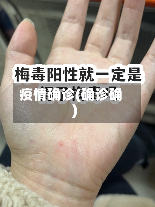 疫情确诊(确诊确)