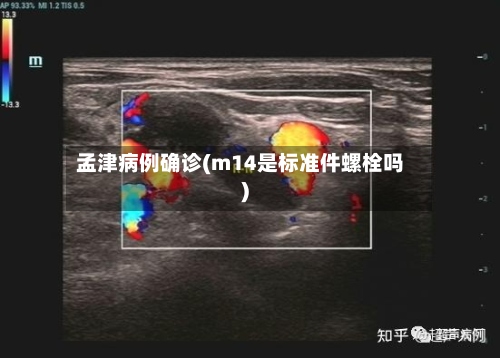 孟津病例确诊(m14是标准件螺栓吗)