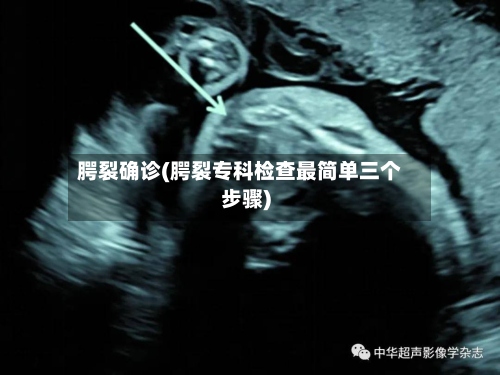 腭裂确诊(腭裂专科检查最简单三个步骤)