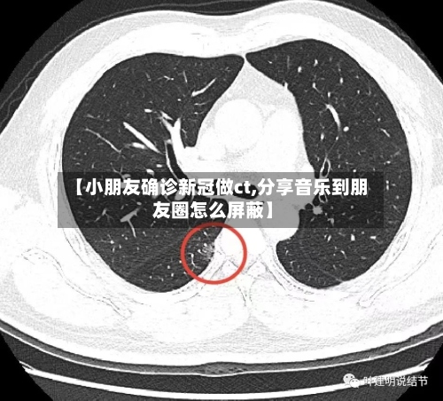 【小朋友确诊新冠做ct,分享音乐到朋友圈怎么屏蔽】
