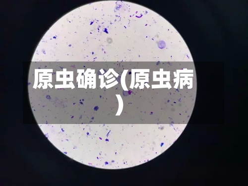 原虫确诊(原虫病)-第3张图片