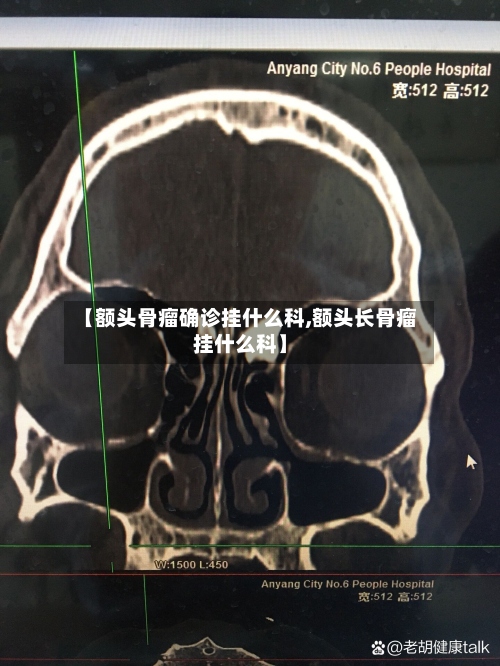 【额头骨瘤确诊挂什么科,额头长骨瘤挂什么科】