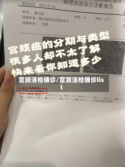 宫颈活检确诊/宫颈活检确诊lisl