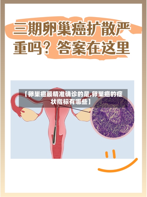 【卵巢癌最精准确诊的是,卵巢癌的症状指标有哪些】