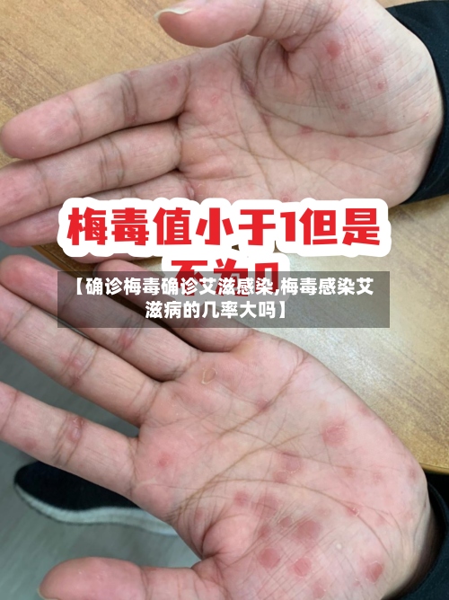【确诊梅毒确诊艾滋感染,梅毒感染艾滋病的几率大吗】