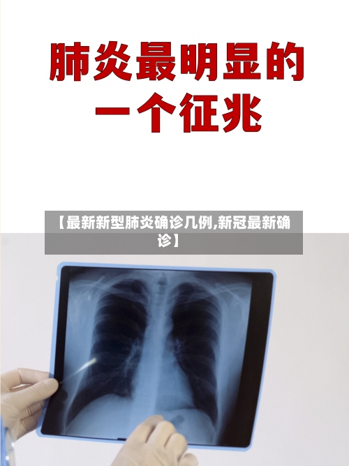 【最新新型肺炎确诊几例,新冠最新确诊】-第2张图片