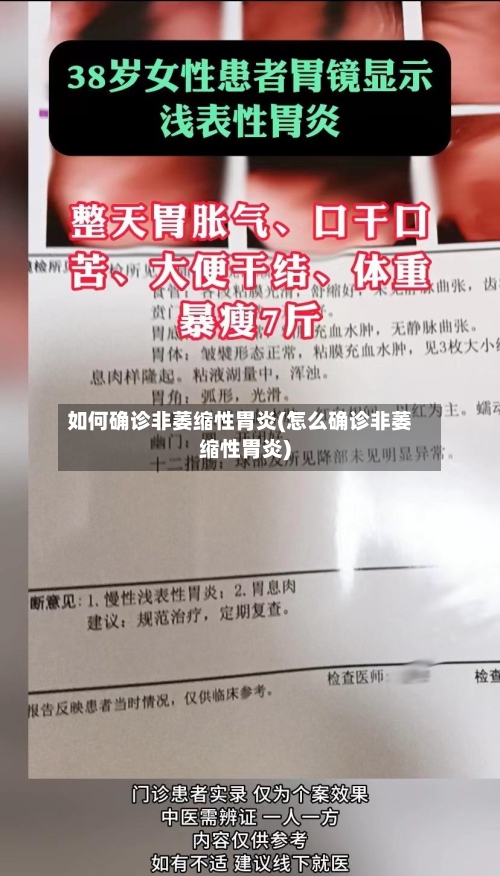 如何确诊非萎缩性胃炎(怎么确诊非萎缩性胃炎)