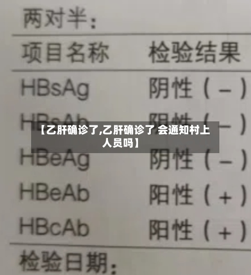 【乙肝确诊了,乙肝确诊了 会通知村上人员吗】