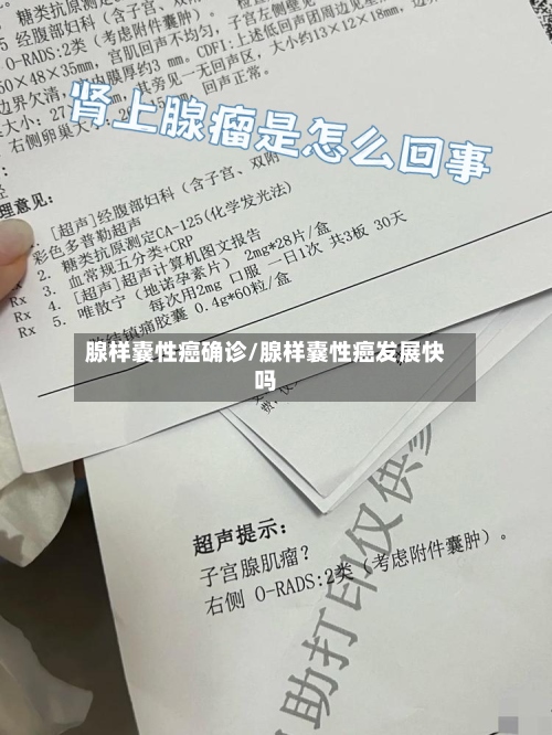 腺样囊性癌确诊/腺样囊性癌发展快吗