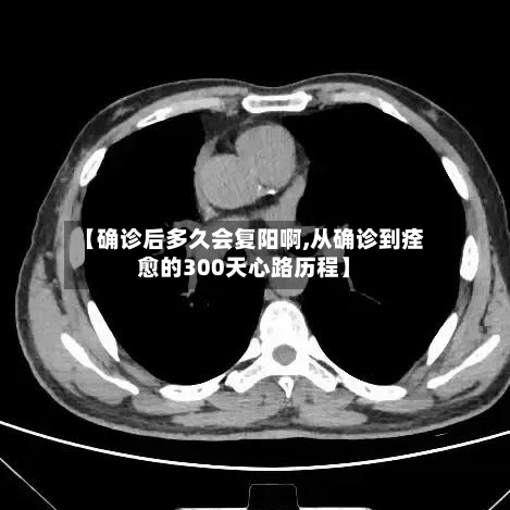 【确诊后多久会复阳啊,从确诊到痊愈的300天心路历程】-第3张图片