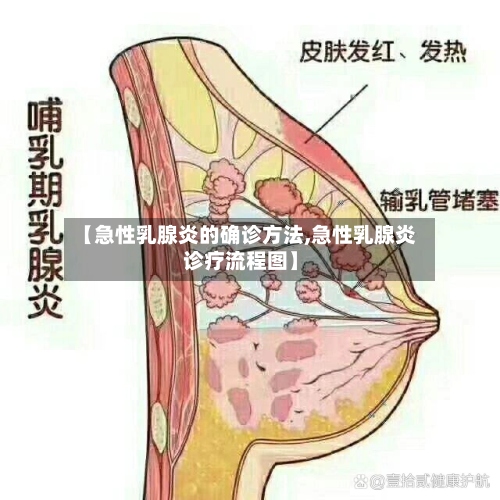 【急性乳腺炎的确诊方法,急性乳腺炎诊疗流程图】-第3张图片