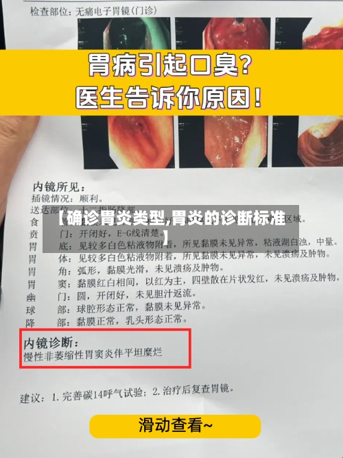 【确诊胃炎类型,胃炎的诊断标准】