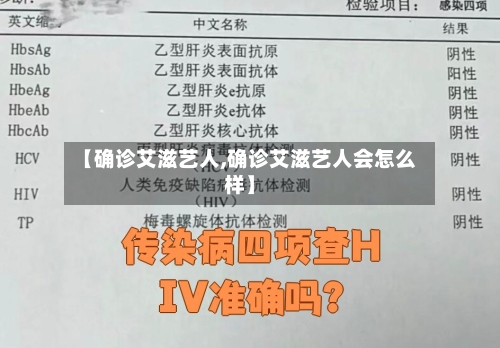 【确诊艾滋艺人,确诊艾滋艺人会怎么样】-第3张图片