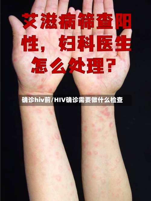 确诊hiv前/HIV确诊需要做什么检查