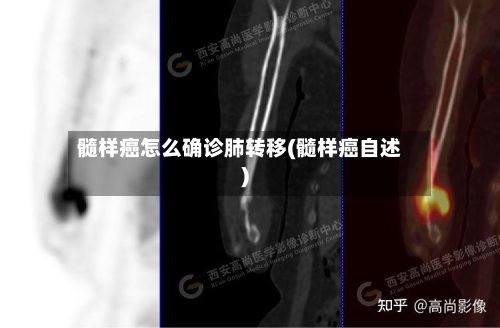髓样癌怎么确诊肺转移(髓样癌自述)-第2张图片