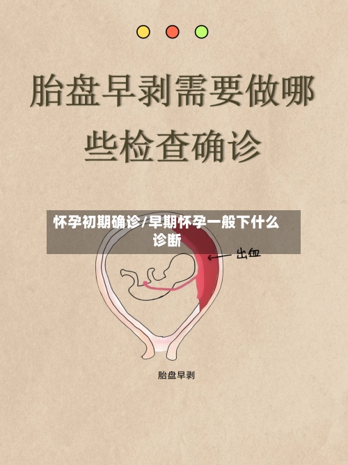 怀孕初期确诊/早期怀孕一般下什么诊断
