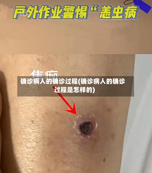 确诊病人的确诊过程(确诊病人的确诊过程是怎样的)-第2张图片