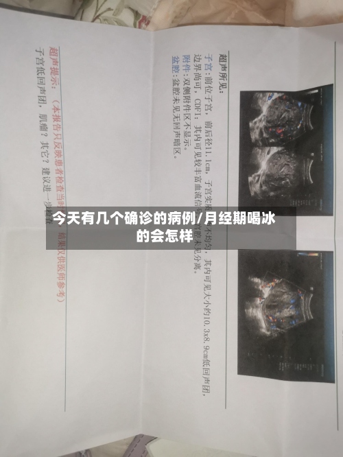 今天有几个确诊的病例/月经期喝冰的会怎样-第2张图片