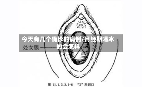 今天有几个确诊的病例/月经期喝冰的会怎样-第3张图片