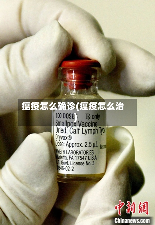 瘟疫怎么确诊(瘟疫怎么治)