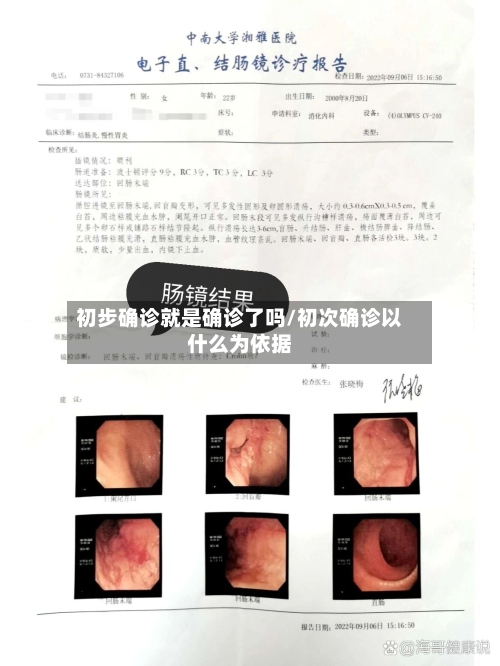 初步确诊就是确诊了吗/初次确诊以什么为依据-第3张图片