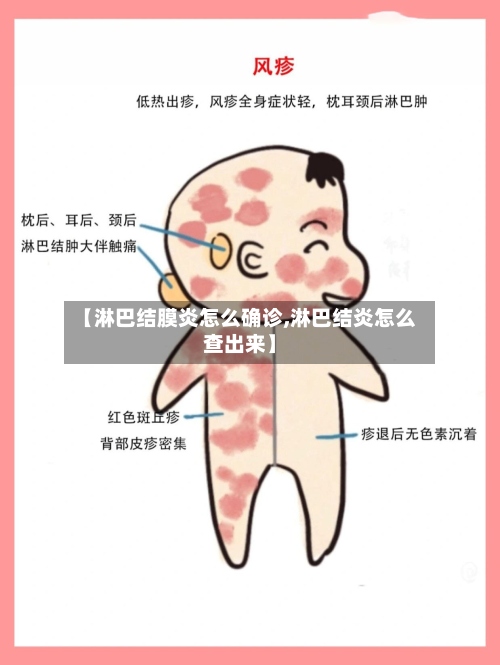 【淋巴结膜炎怎么确诊,淋巴结炎怎么查出来】-第3张图片
