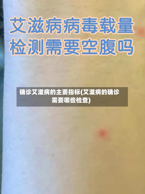 确诊艾滋病的主要指标(艾滋病的确诊需要哪些检查)