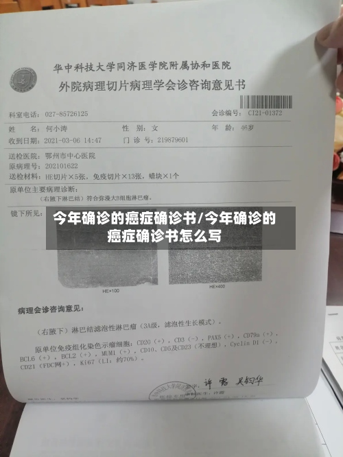 今年确诊的癌症确诊书/今年确诊的癌症确诊书怎么写