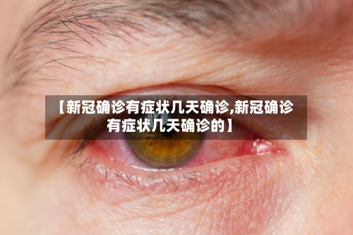 【新冠确诊有症状几天确诊,新冠确诊有症状几天确诊的】-第2张图片