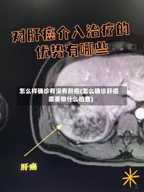 怎么样确诊有没有肝癌(怎么确诊肝癌需要做什么检查)