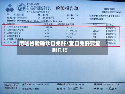 用啥检验确诊自免肝/查自免肝要查哪几项
